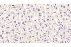 Detection of Raftlin in Mouse Liver Tissue using Polyclonal Antibody to Raft Linking Protein (Raftlin) (RFTN1 antibody  (AA 207-451))