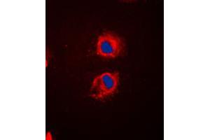 Immunofluorescent analysis of EPS8L2 staining in HeLa cells. (EPS8-Like 2 antibody  (N-Term))