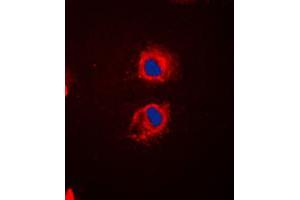Immunofluorescent analysis of EPS8L2 staining in HeLa cells. (EPS8-Like 2 antibody  (N-Term))
