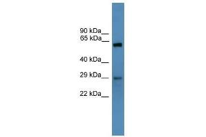 Western Blot showing TP53RK antibody used at a concentration of 1-2 ug/ml to detect its target protein. (TP53RK antibody  (N-Term))