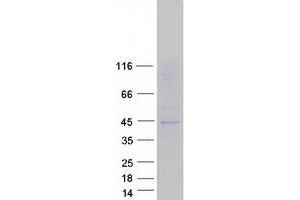 SLC16A13 Protein (Myc-DYKDDDDK Tag)