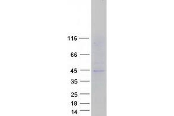 SLC16A13 Protein (Myc-DYKDDDDK Tag)