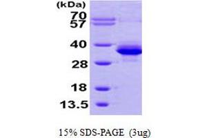SDS-PAGE (SDS) image for Phosphomannomutase 1 (PMM1) (AA 1-262) protein (His tag) (ABIN667263)