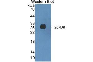 Western blot analysis of the recombinant protein. (CDK16 antibody  (AA 165-446))