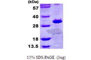 SDS-PAGE (SDS) image for Electron-Transfer-Flavoprotein, beta Polypeptide (ETFB) (AA 1-255) protein (His tag) (ABIN667906) (ETFB Protein (AA 1-255) (His tag))