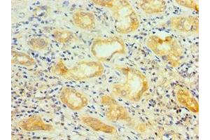 Immunohistochemistry of paraffin-embedded human kidney tissue using ABIN7168971 at dilution of 1:100 (SRSF4 antibody  (AA 1-180))