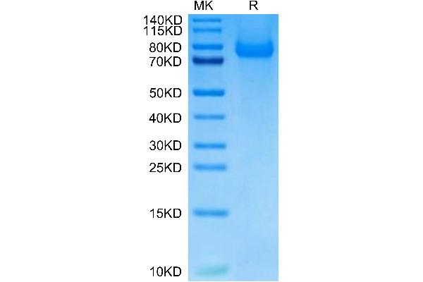 SELPLG Protein (AA 34-356) (His tag)