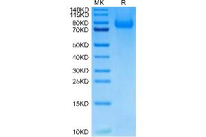 Cynomolgus PSGL-1 on Tris-Bis PAGE under reduced condition. (SELPLG Protein (AA 34-356) (His tag))