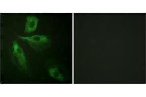 Immunofluorescence analysis of HeLa cells, using ADD1 (Ab-445) Antibody. (alpha Adducin antibody  (AA 411-460))