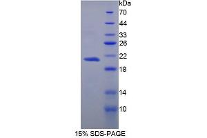 SDS-PAGE analysis of Human Carboxypeptidase N1 Protein.