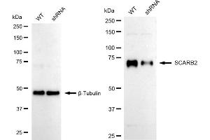 Western blotting analysis using SCARB2 antibody (ABIN7800277). (Recombinant SCARB2 antibody)