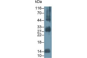 Detection of HBa1 in Human Lung lysate using Polyclonal Antibody to Hemoglobin Alpha 1 (HBa1)