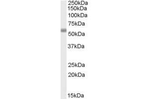 Western Blotting (WB) image for anti-Family with Sequence Similarity 177, Member B (FAM177B) (C-Term) antibody (ABIN2791531) (FAM177B antibody  (C-Term))