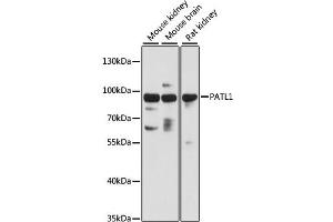 Western blot analysis of extracts of various cell lines, using PATL1 antibody (ABIN6293952) at 1:3000 dilution. (PATL1 antibody)