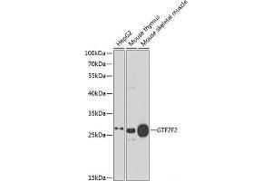 Western blot analysis of extracts of various cell lines using GTF2F2 Polyclonal Antibody at dilution of 1:1000. (GTF2F2 antibody)