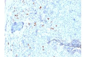 Formalin-fixed, paraffin-embedded human Tonsil stained with IgG4 Mouse Monoclonal Antibody (IGHG4/1345). (IGHG4 antibody)