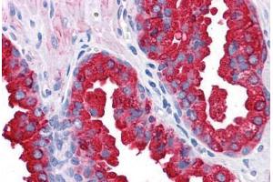 Human Prostate: Formalin-Fixed, Paraffin-Embedded (FFPE) (ERG antibody  (AA 1-160))
