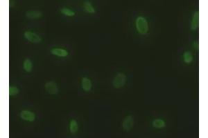 Immunofluorescent staining of HeLa cells using anti-SOX17 mouse monoclonal antibody (ABIN2452369). (SOX17 antibody  (AA 177-414))