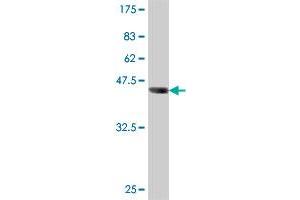 Western Blot detection against Immunogen (37 KDa) . (TIMELESS antibody  (AA 1109-1207))