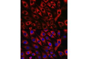 Immunofluorescence analysis of NIH/3T3 cells using UFL1 Rabbit pAb (ABIN7271213) at dilution of 1:50 (40x lens). (UFL1 antibody)
