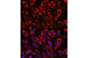 Immunofluorescence analysis of NIH/3T3 cells using UFL1 Rabbit pAb (ABIN7271213) at dilution of 1:50 (40x lens). (UFL1 antibody)