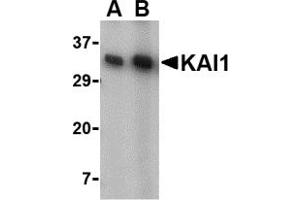 Western Blotting (WB) image for anti-CD82 (CD82) (C-Term) antibody (ABIN1030462) (CD82 antibody  (C-Term))