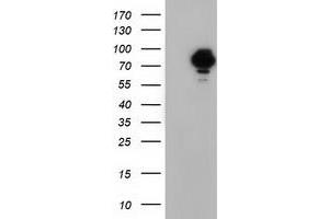 HEK293T cells were transfected with the pCMV6-ENTRY control (Left lane) or pCMV6-ENTRY VWA5A (Right lane) cDNA for 48 hrs and lysed. (VWA5A antibody)