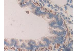 DAB staining on IHC-P; Samples: Rat Lung Tissue (PRCP antibody  (AA 113-350))