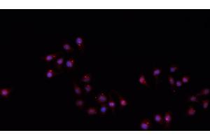 ABIN6266710 staining A549 cells by IF/ICC. (Hairless antibody)