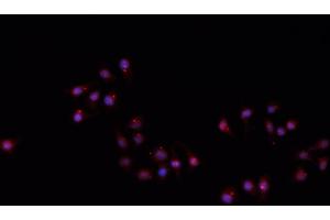 ABIN6266710 staining A549 cells by IF/ICC. (Hairless antibody)