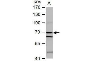 WB Image SHP1 antibody detects SHP1 protein by western blot analysis. (SHP1 antibody)