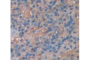 IHC-P analysis of Mouse Tissue, with DAB staining. (ITK antibody  (AA 368-625))