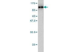 Western Blot detection against Immunogen (89. (Radixin antibody  (AA 1-583))