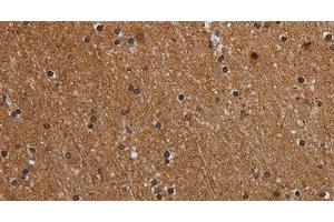 Immunohistochemistry of paraffin-embedded Human brain using MT-ND1 Polyclonal Antibody at dilution of 1:50 (MT-ND1 antibody)