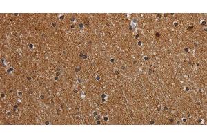 Immunohistochemistry of paraffin-embedded Human brain using MT-ND1 Polyclonal Antibody at dilution of 1:50
