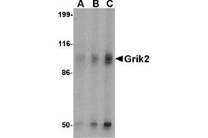 Western Blotting (WB) image for anti-Glutamate Receptor, Ionotropic, Kainate 2 (GRIK2) antibody (ABIN1030201) (GRIK2 antibody)