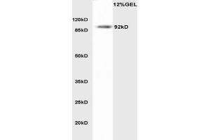 LDLR anticorps  (AA 781-860)