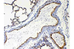 Immunohistochemistry (IHC) image for anti-Tetraspanin 12 (TSPAN12) (AA 111-224) antibody (ABIN5693040)