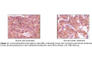 Image no. 1 for anti-Steroid Receptor RNA Activator 1 (SRA1) antibody (ABIN232101) (SRA1 antibody)