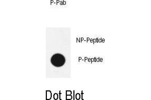 Dot blot analysis of anti-phospho-Sox2-p Phospho-specific Pab (ABIN650887 and ABIN2839829) on nitrocellulose membrane.