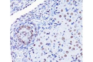 Immunohistochemistry of paraffin-embedded Rat ovary using Acetyl-Histone H4-K8 Polyclonal Antibody at dilution of 1:100 (40x lens). (Histone H4 antibody  (acLys8))