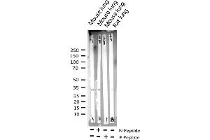 Western blot analysis of Phospho-CDC2 (Tyr15) expression in various lysates (CDK1 antibody  (pTyr15))