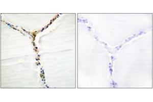 Immunohistochemistry analysis of paraffin-embedded human thyroid gland, using AhR (Phospho-Ser36) Antibody. (Aryl Hydrocarbon Receptor antibody  (pSer36))