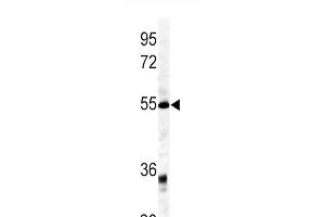 Western blot analysis of GDF6 antibody (C-term) (ABIN391699 and ABIN2841599) in mouse kidney tissue lysates (35 μg/lane). (GDF6 antibody  (C-Term))