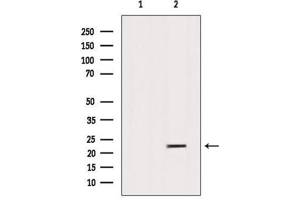SAR1B antibody  (Internal Region)