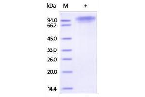 Human C1q R1, His Tag on SDS-PAGE under reducing (R) condition. (CD93 Protein (CD93) (AA 22-580) (His tag))