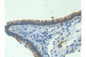 Detection of ITaC in Mouse Lung Tissue using Polyclonal Antibody to Interferon Inducible T-Cell Alpha Chemoattractant (ITaC) (CXCL11 antibody  (AA 22-100))