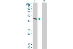 Western Blot analysis of FAS expression in transfected 293T cell line by FAS monoclonal antibody (M05), clone 2G3. (FAS antibody  (AA 20-119))