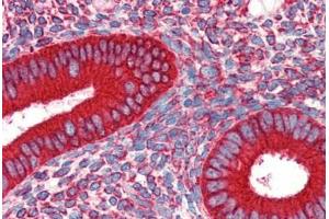 Human Uterus (formalin-fixed, paraffin-embedded) stained with HSP90B1 antibody ABIN462106 at 10 ug/ml followed by biotinylated secondary antibody, alkaline phosphatase-streptavidin and chromogen. (GRP94 antibody)
