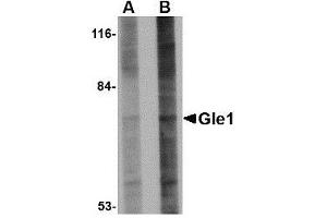 Western blot analysis of Gle1 in 293 cell lysate with AP30367PU-N Gle1 antibody at (A) 1 and (B) 2 μg/ml. (GLE1 antibody  (Center))